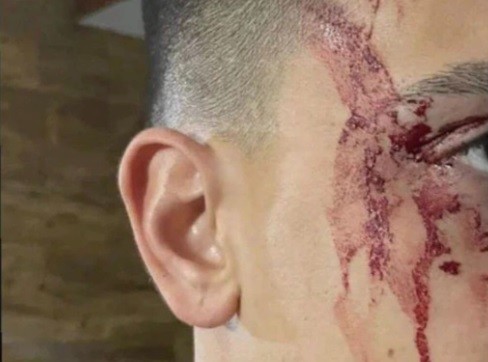 Asaltaron a Agustín Sandez: cuatro detenidos por el ataque al jugador de Boca | Actualidad