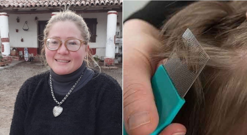 Trabaja medio día y para completar sus ingresos se ofrece como "sacadora de piojos" | Curiosidades