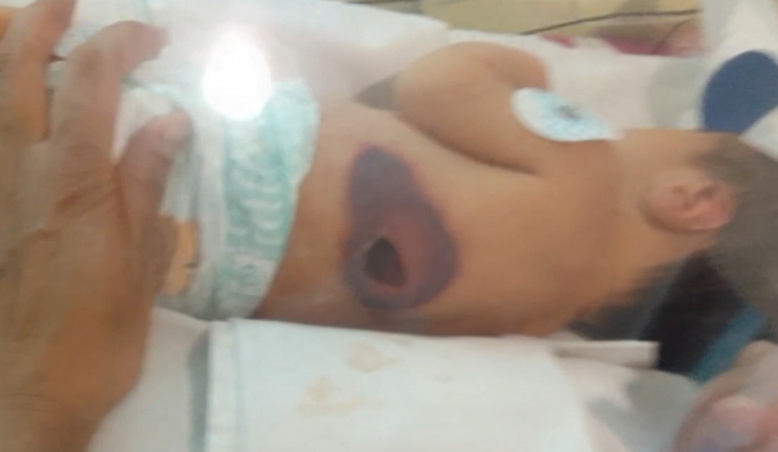 Habló la madre de uno de los bebés sobrevivientes del Hospital Neonatal | Córdoba