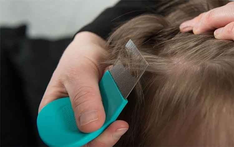 Una cordobesa se gana la vida sacando piojos: cobra $500 la sesión | Córdoba