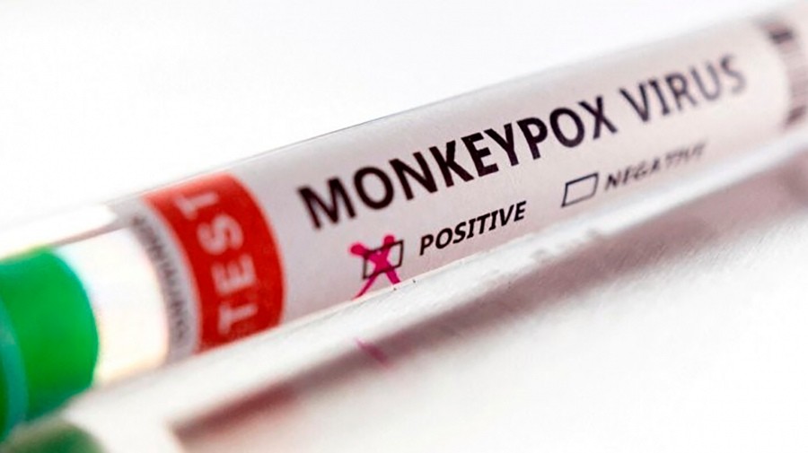 Viruela del mono: ya son 133 los casos confirmados en Argentina | Actualidad