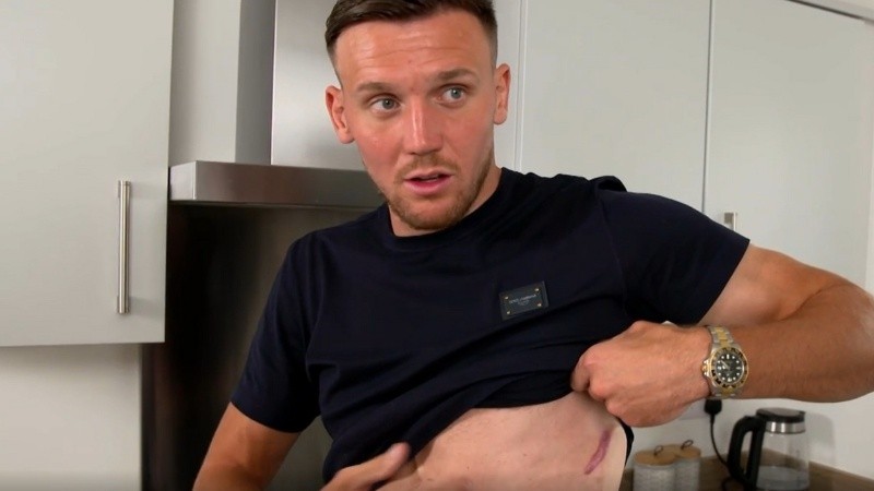 Futbolista mostró el desfibrilador que le implantaron debajo de su piel | Deportes