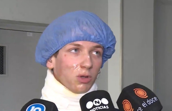 Uno de los alumnos quemados fue dado de alta y habló sobre lo sucedido | Córdoba