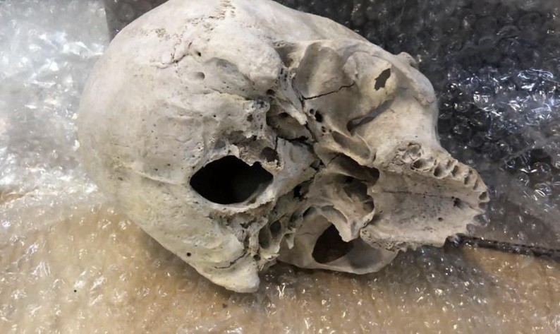 Una calavera y una factura por 295 dólares: el misterio en un encomienda secuestrada por la Aduana | Actualidad