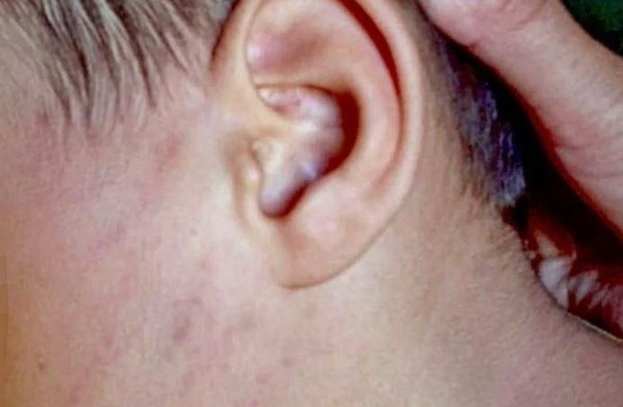 Denuncian a padres por "lesiones graves" a su hijo de 4 años en Santiago del Estero | Actualidad