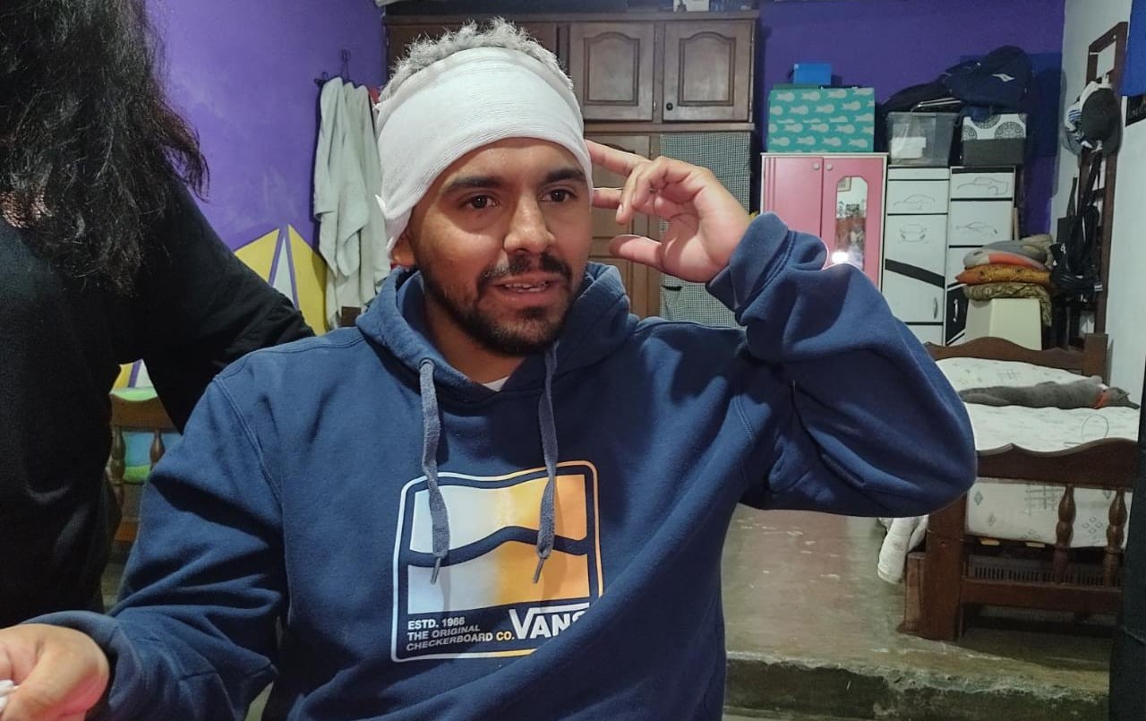 Le disparan en la cabeza para robarle el celular: está vivo de milagro | Córdoba