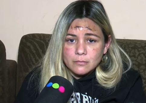 Gisel, la mujer baleada en la cabeza en un asalto, se fue de Córdoba | Córdoba