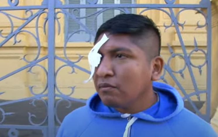 Lo golpearon en el ojo para robarle y ahora puede perderlo | Córdoba
