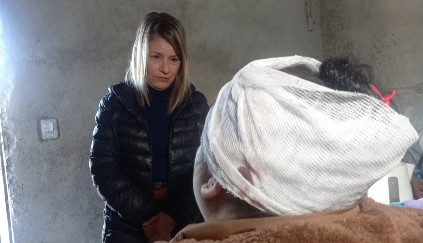 Habló la mujer que fue baleada en la nuca por su ex pareja: “Me salvé por dos milímetros” | Córdoba