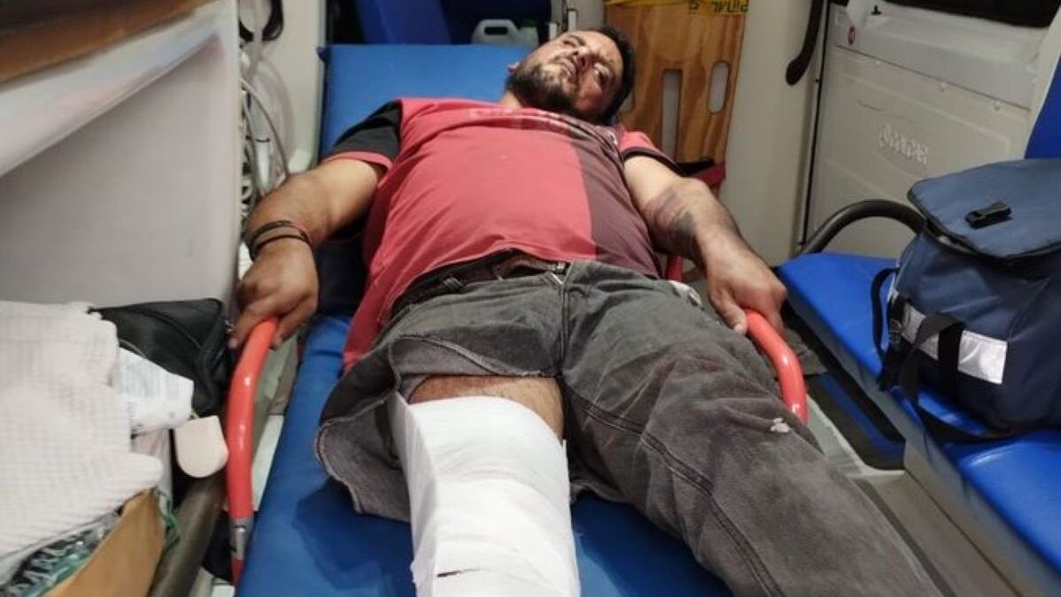 Rosario: atropellaron a "Kiko de zona sur", lo dejaron tirado y se dieron a la fuga | Actualidad