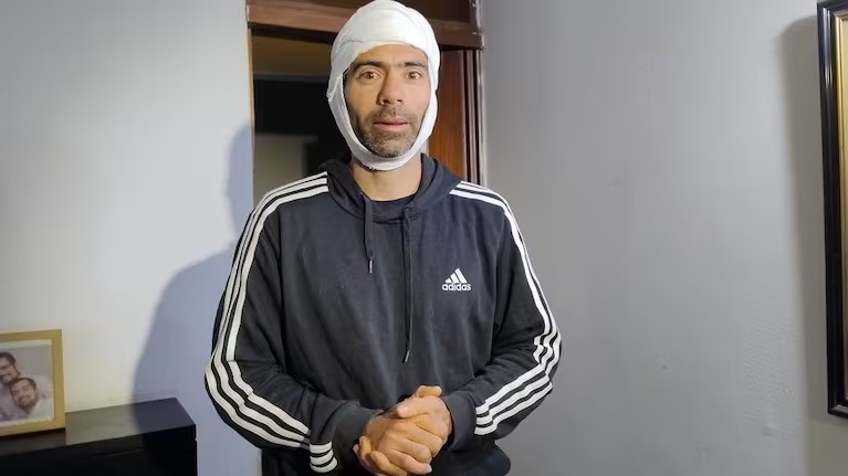 Robo y una golpiza sangrienta: un nuevo robo piraña en Córdoba | Córdoba