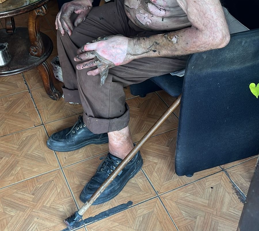 Un hombre se lesionó cuando intentaba reparar una falla eléctrica | Córdoba