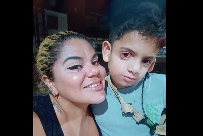 El caso del niño Milo Lockett con anomalías faciales: necesita una casa sin humedad para vivir sin ahogarse | Actualidad