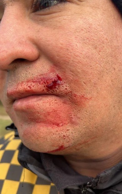 Video: agredió a un policía durante un control y fue detenido | Córdoba