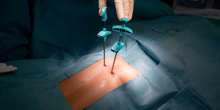 Avance en salud pública: Córdoba incorpora cirugías endoscópicas de columna | Córdoba