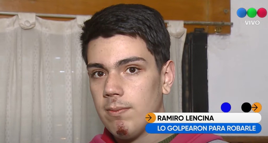 El adolescente con Asperger que perdió dos dientes en un asalto recuperó su sonrisa | Córdoba