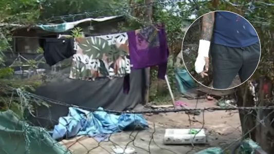 Le robaron el horno con el que hacía pan para mantener a sus hijos y ahora no puede trabajar por una fractura