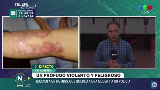 Buscan a un hombre que golpeó a una mujer y a un policía
