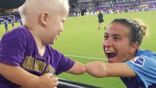 El conmovedor encuentro de una jugadora de fútbol y un nene que tienen el mismo problema físico en el brazo