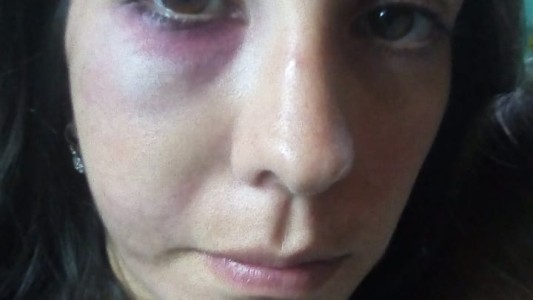 Su novio la golpeó, perdió un embarazo y murió: la lucha de la familia para que reconozcan el femicidio