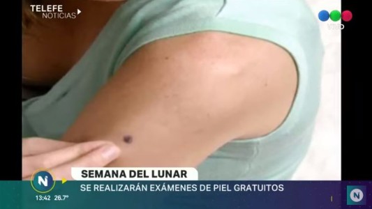 Semana del lunar: controles gratuitos en el Hospital San Roque