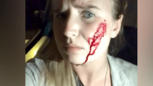 Una activista vegana liberó a 16 conejos y fue corrida a los tiros por granjeros