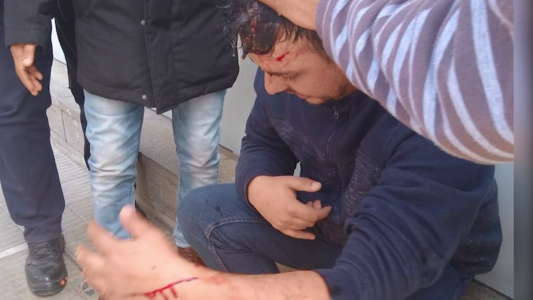 Camarógrafo de Telefe Noticias agredido por manifestantes de Luz y Fuerza