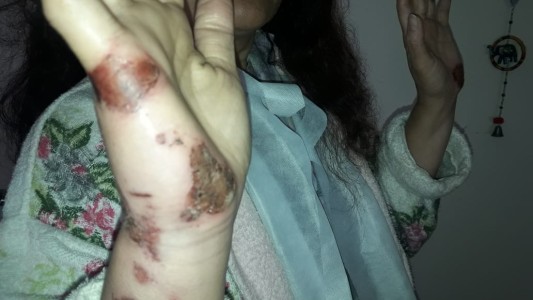 VIIDEO: Violento robo, la arrastraron tres cuadras colgada de un auto