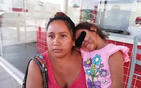 Fue a buscar a su hija al jardín de infantes y se la entregaron con la cara desfigurada