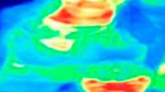 La mujer que detectó que tenía cáncer de mama por la cámara térmica de una atracción turística