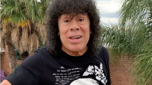 La mona Jiménez contó de qué lo operaron