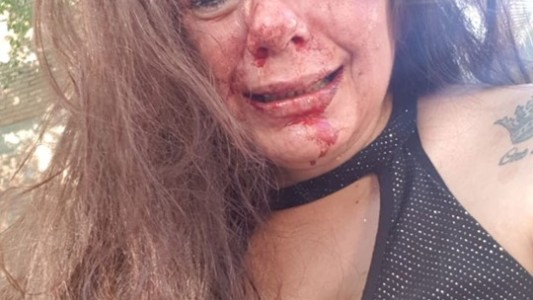 Santiago del Estero: un policía golpeó brutalmente a su novia a la salida de un boliche