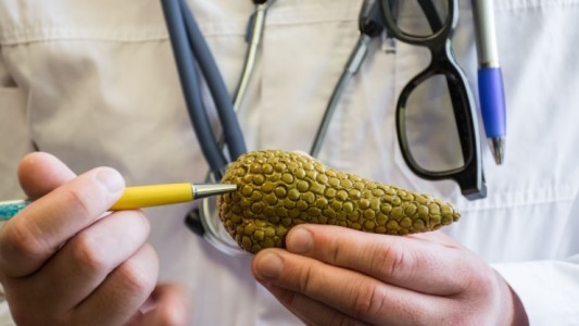 Sólo el 10 por ciento de los casos de cáncer de páncreas se detecta a tiempo