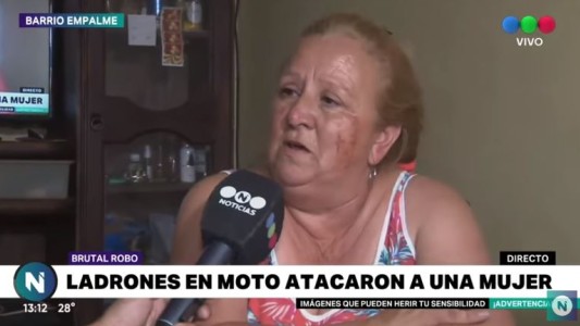 Habló Norma, la mujer asaltada y golpeada salvajemente en Barrio Empalme