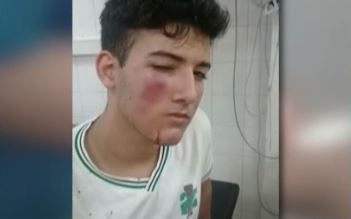 Buenos Aires: brutal golpiza a un alumno con una manopla en Barracas, tiene fisura de maxilar