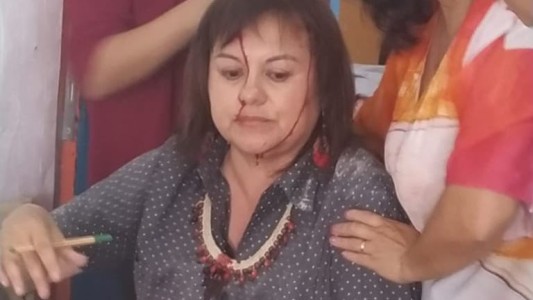 Buenos Aires: cayó la mampostería del techo de una escuela sobre una docente que daba clases