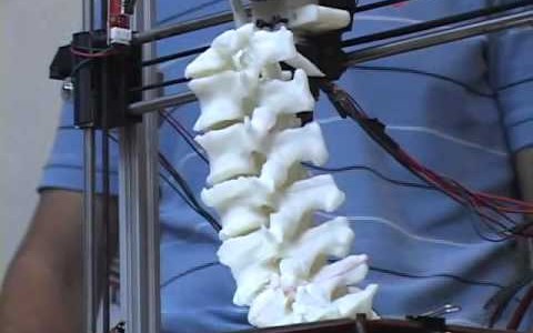 Científicos argentinos desarrollan "huesos" con impresoras 3D