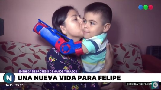 En la semana del voluntariado, 21 prótesis en manos de quienes las necesitan