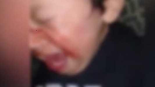 Una madre le fracturó el cráneo a su hijo de 7 años porque gastó dinero en golosinas