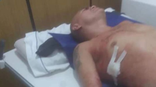 Apuñalaron al boxeador Rodrigo “La Hiena” Barrios en Capilla del Monte