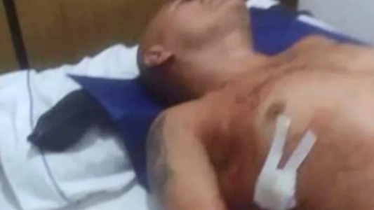 Detuvieron al presunto agresor de "La Hiena" Barrios