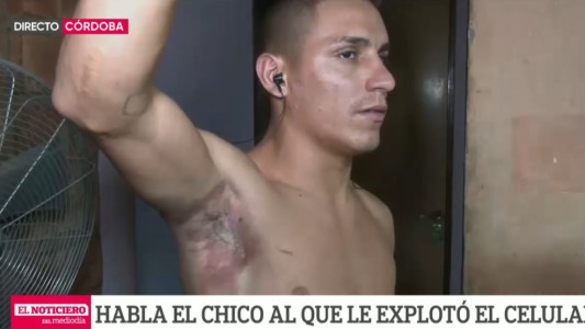 A un joven le explotó el celular mientras dormía: "Me desperté y estaba en llamas"
