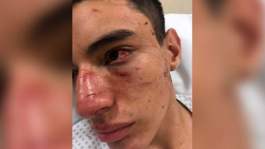 Un rugbier sufrió una brutal golpiza y sugirió que hubo "ensañamiento" por el crimen de Fernando