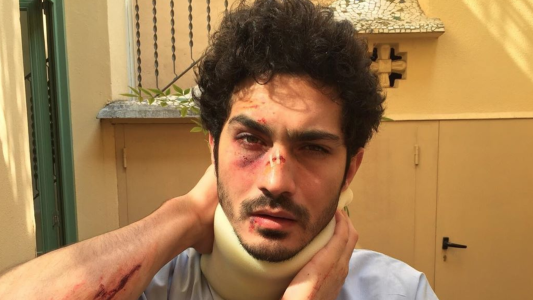 La foto del Chino Darín que preocupó a sus seguidores