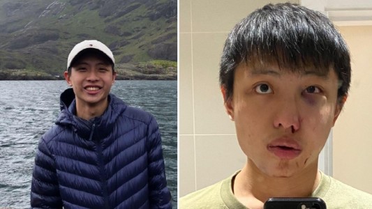 "No quiero tu coronavirus en mi país": brutal ataque a un joven en Londres