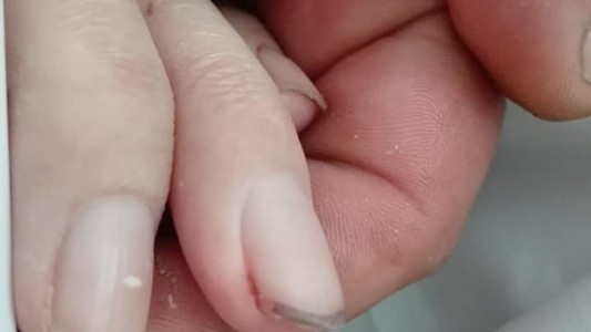 Agoniza un nene que recibió una bala perdida: "Mi hijo es tratado como un trapo sucio"