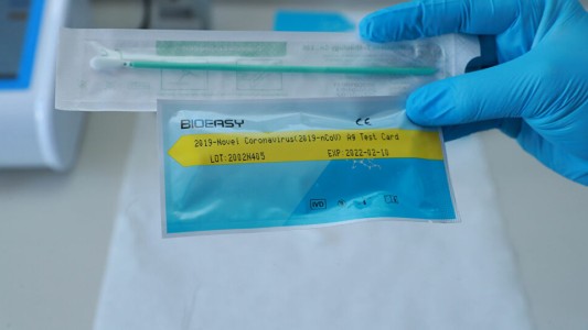 Sin reactivos, los análisis locales de coronavirus quedan a medias: de 90 sólo se hicieron 14