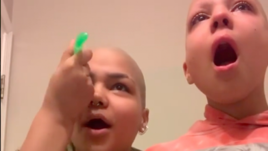 La chica que se afeitó la cabeza y las cejas para acompañar a su hermana con cáncer
