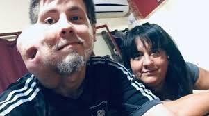 El pedido de un joven que tiene un extraño tumor y necesita operarse en plena pandemia de coronavirus