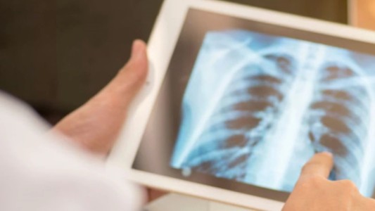 Alerta por el avance de otras enfermedades mortales a la sombra del coronavirus